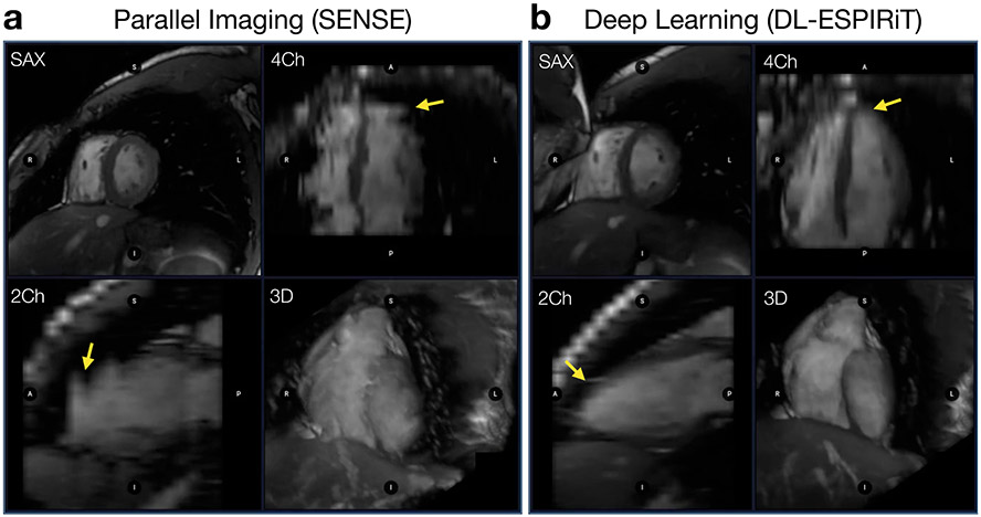 Figure 11: