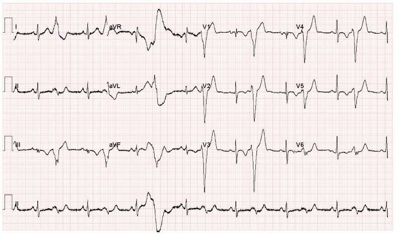 Fig. 1