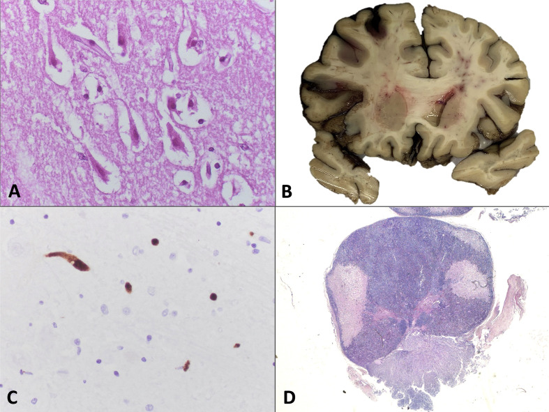 Fig. 3