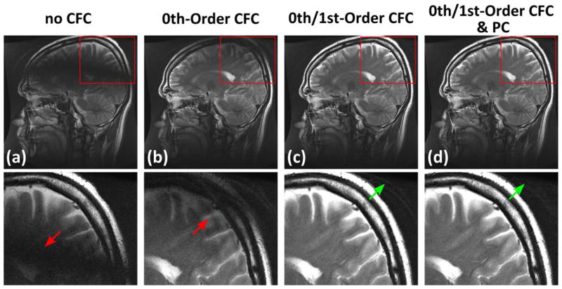 FIG. 6