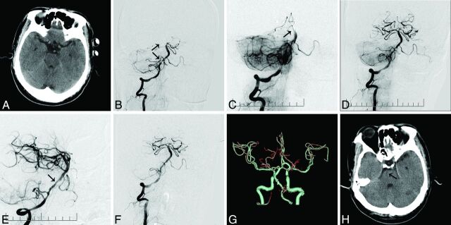 Fig 2.