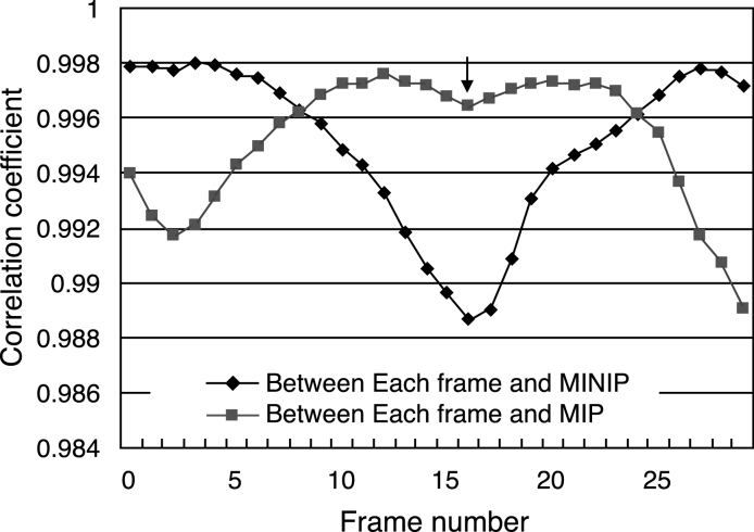 Fig 11