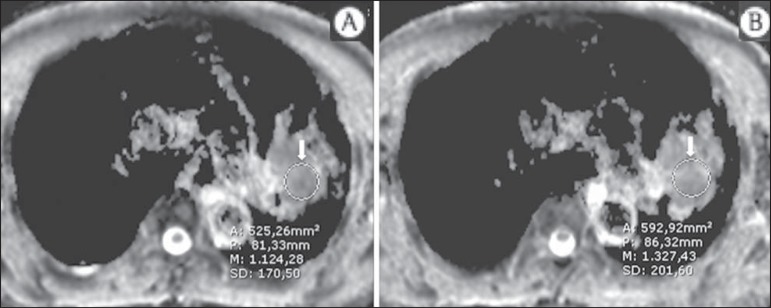 Figure 11