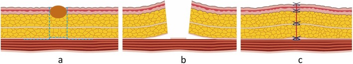 Fig. 29