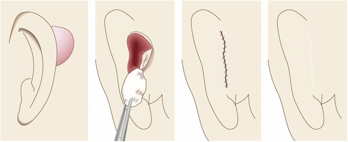 Fig. 30