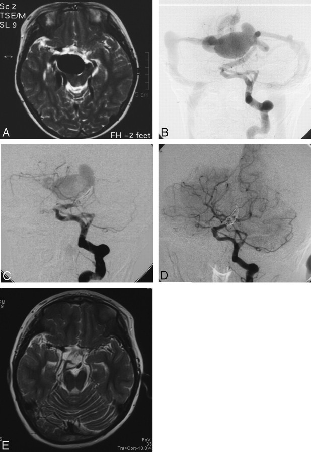 Fig 3.