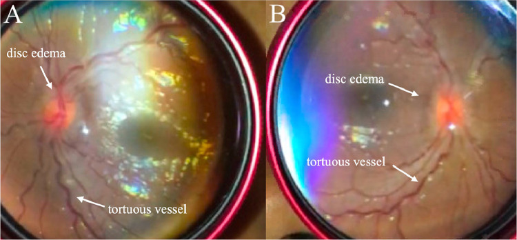 Fig 1