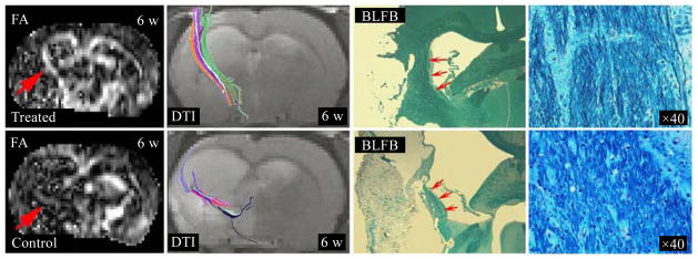 Fig. 11