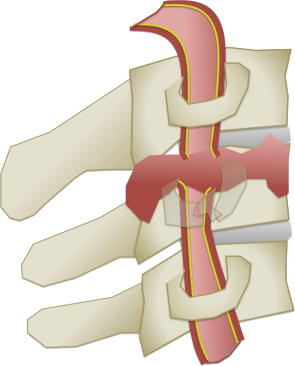 Figure 6g.