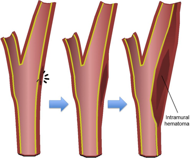 Figure 3b.