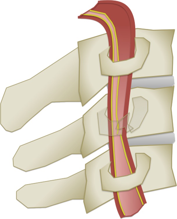 Figure 6c.