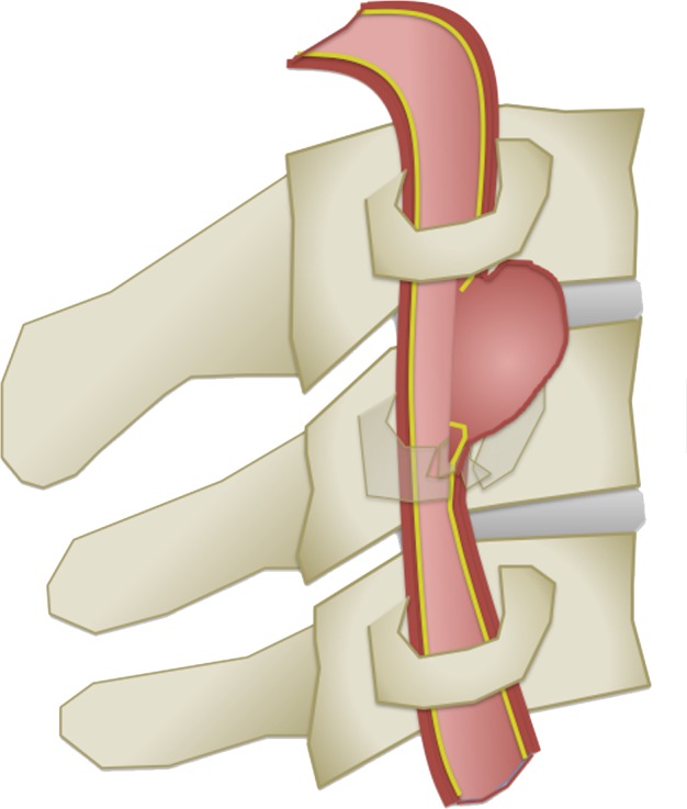 Figure 6e.