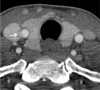Figure 11a.