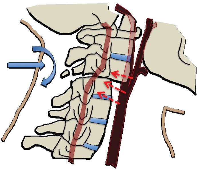 Figure 2c.