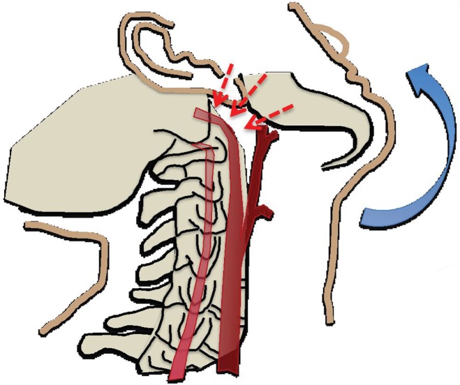 Figure 2a.