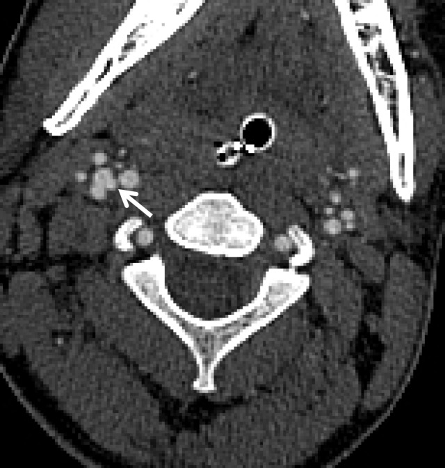 Figure 21a.