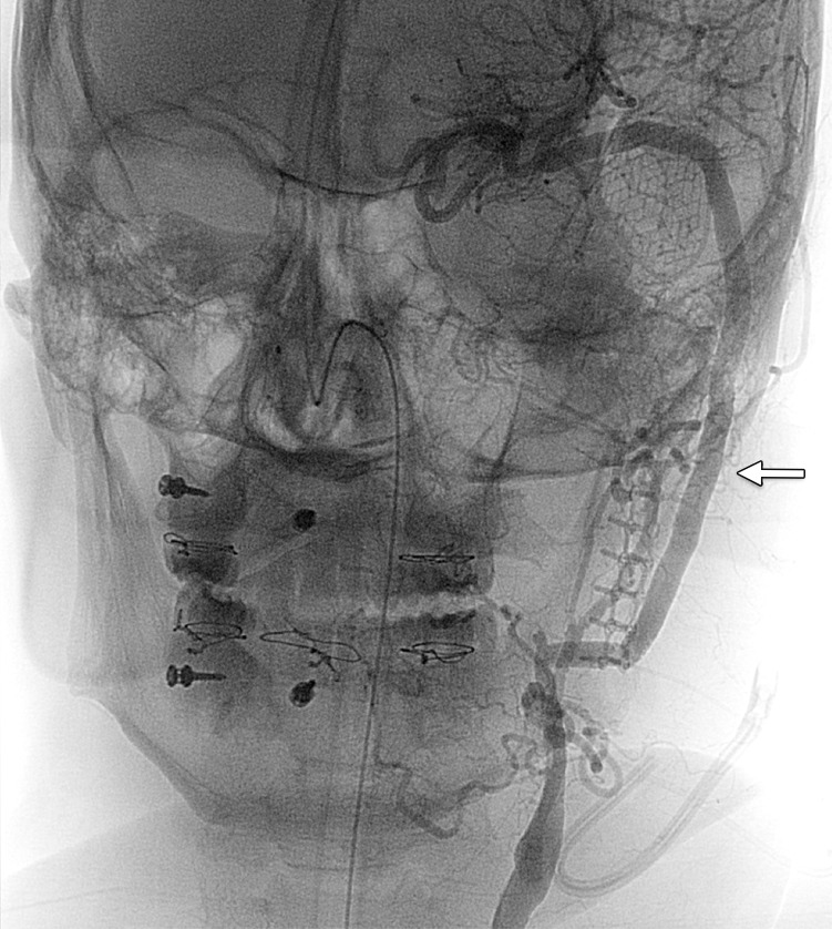 Figure 23b.