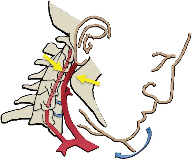 Figure 2b.