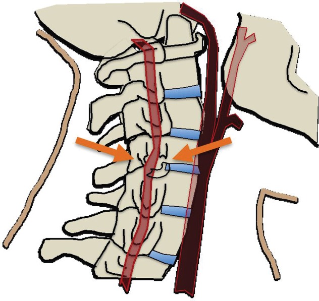 Figure 2d.