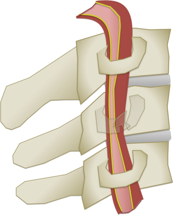 Figure 6d.