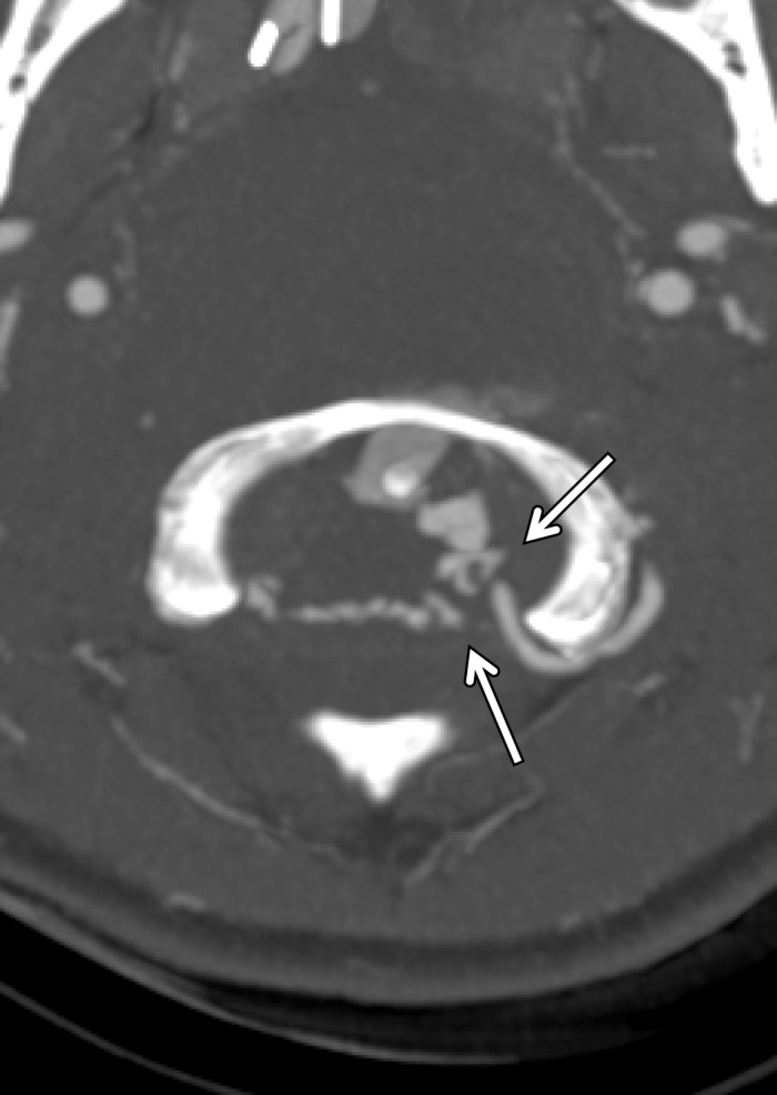 Figure 18b.