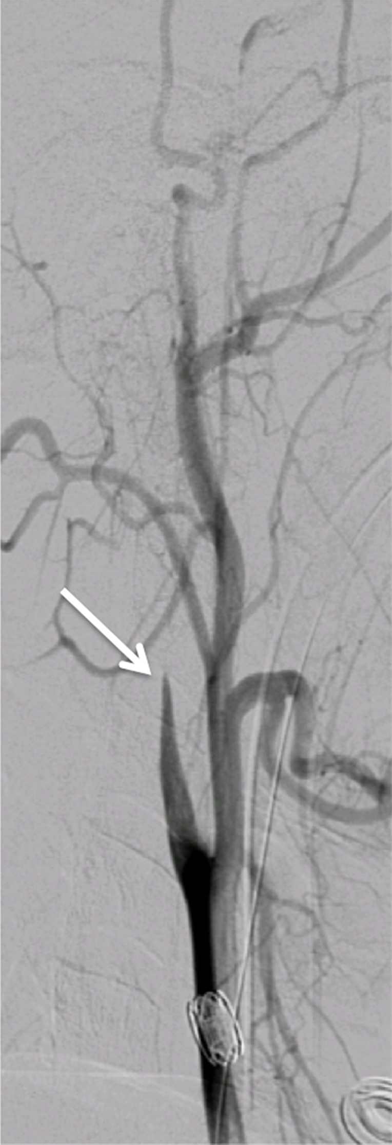 Figure 16b.