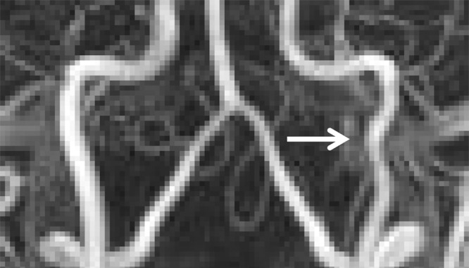 Figure 26c.