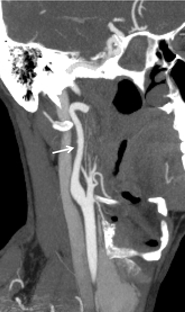 Figure 24b.