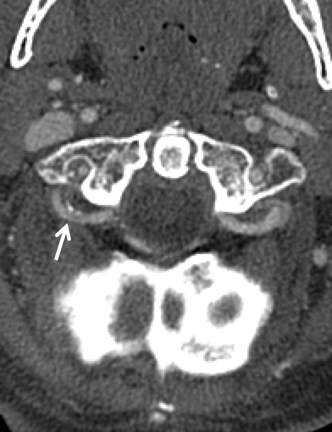 Figure 20b.