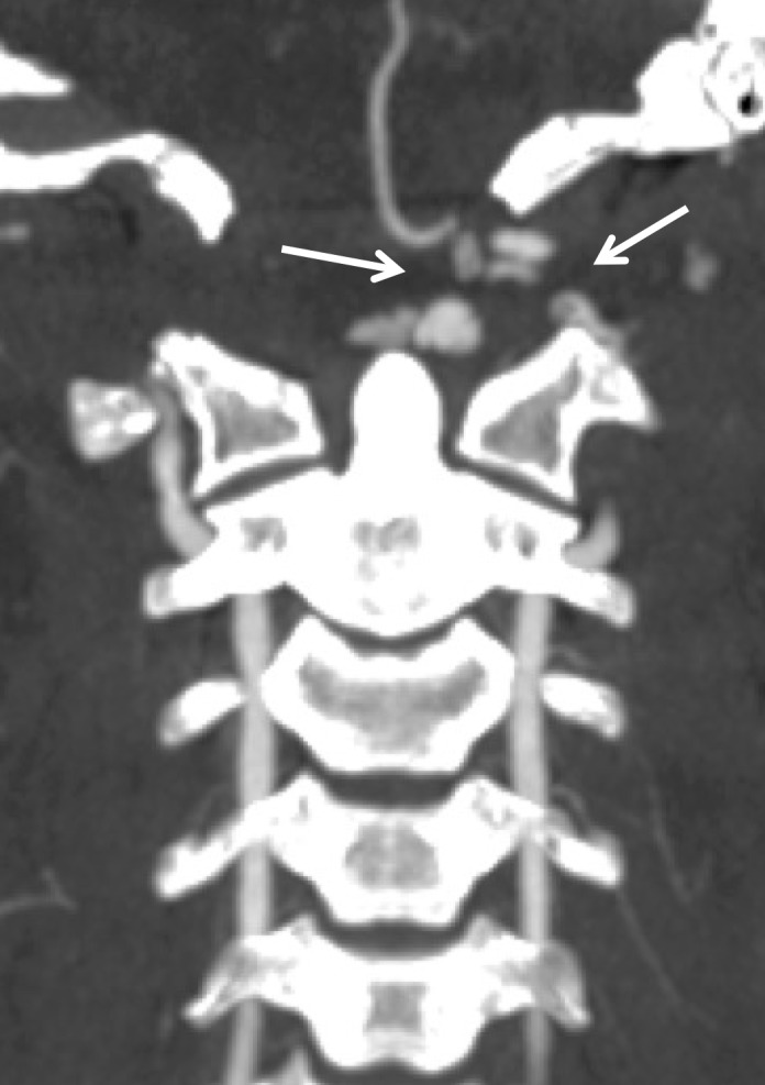 Figure 18c.