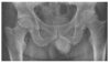 Figure 3A