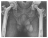 Figure 2B