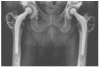 Figure 2C