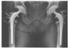 Figure 3C