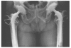 Figure 3B