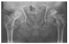 Figure 2A