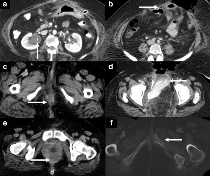 Figure 12.