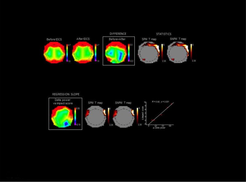 Extended Multiple-Field High-Definition transcranial direct current ...