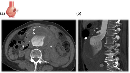 FIGURE 2