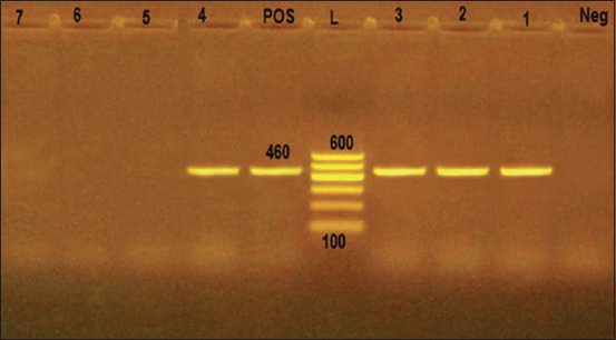 Figure-1