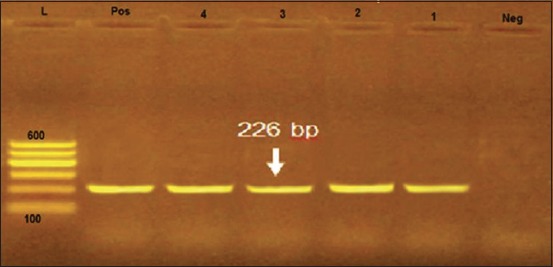 Figure-2