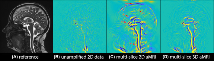 FIGURE 3