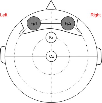 Fig. 1