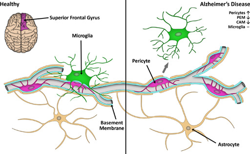 graphic file with name GLIA-71-1847-g002.jpg