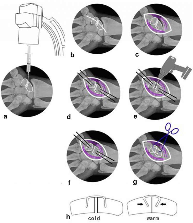 Fig. 3