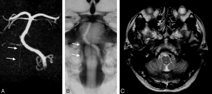 Fig 4.