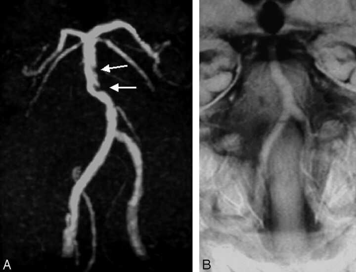 Fig 2.