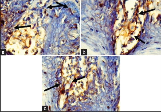 Figure-3