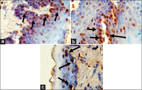 Figure-5