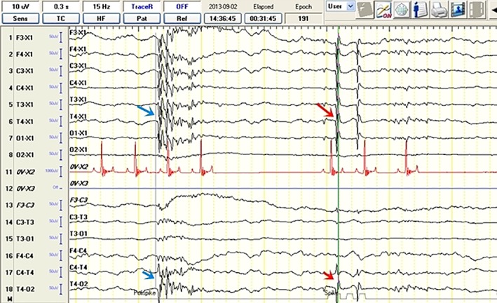 Figure 6